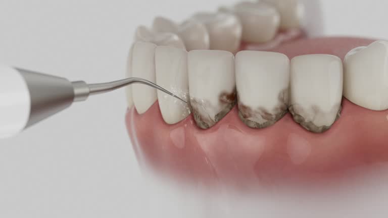 Reliable Wisdom Tooth Removal contractor in Pike County County, GA by Dentist Open Now